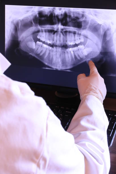 Best Emergency Wisdom Teeth Removal in Franklin Furnace, OH